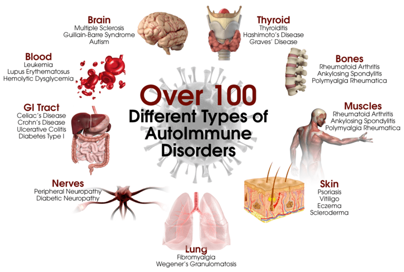 Autoimmune Disease, Causes and Treatments